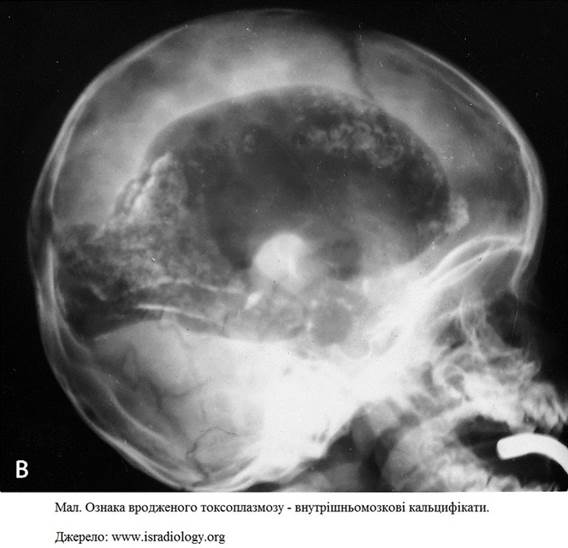 aa_2_2_l_13_TORCH_01