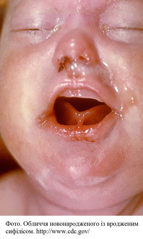 aa_2_2_l_13_TORCH_26