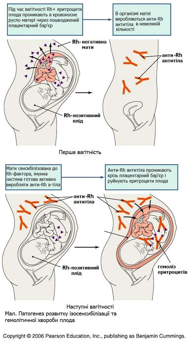 Реферат: Родові травми і післяродові хвороби 4 ступені